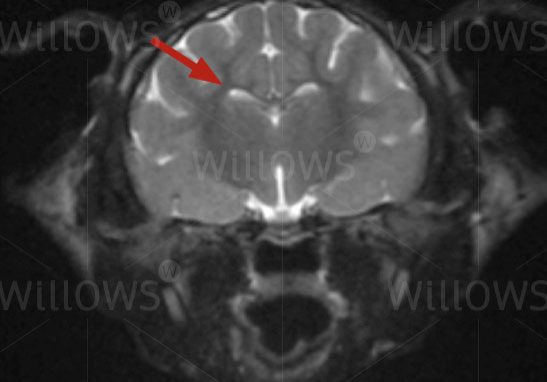 what-is-an-mri-diagram