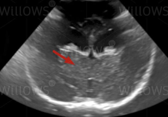 what-is-an-mri-diagram