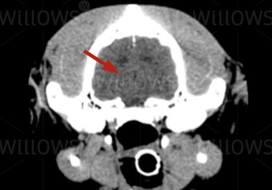 what-is-an-mri-diagram