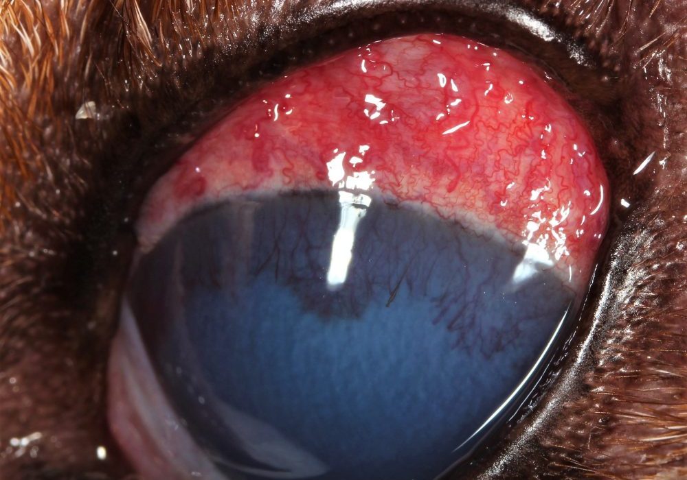 lens-luxation-close-up-eye